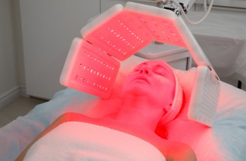 Фотодинамическая терапия кожи HELEO4 – от морщин, пигментации и акне!