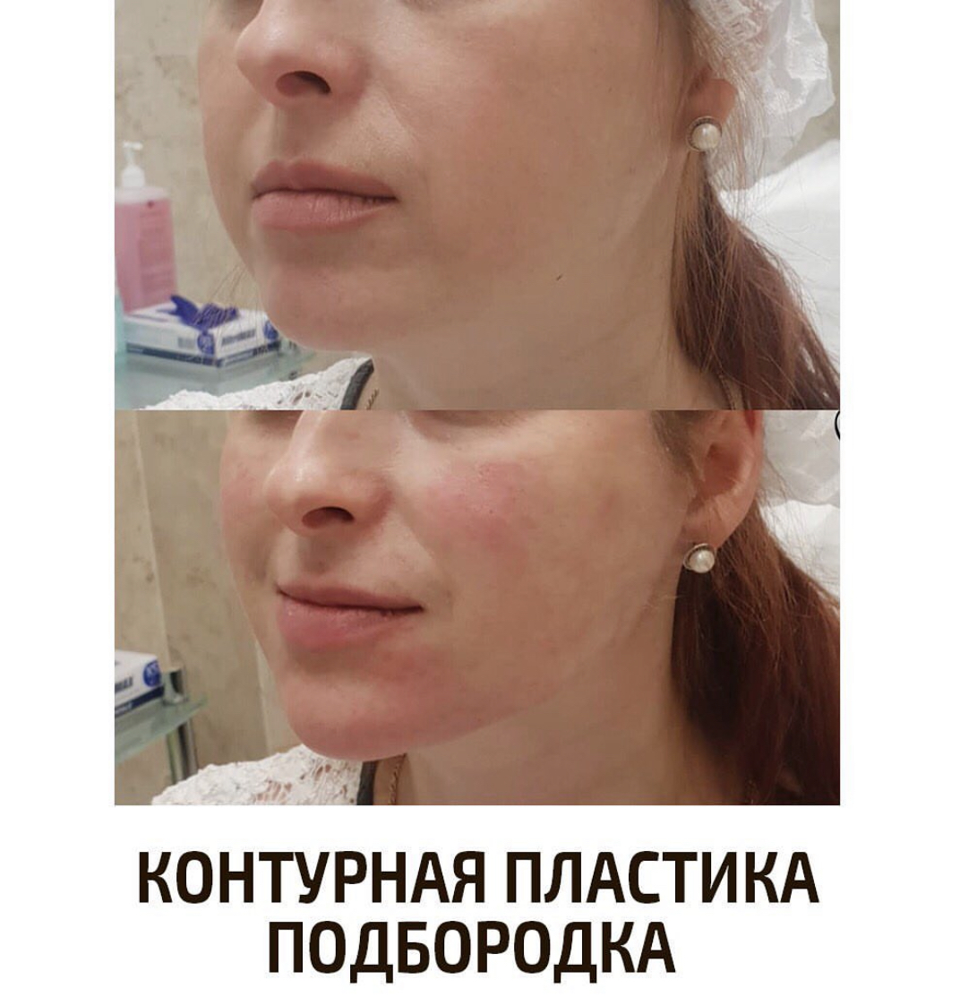 Ибракова Ольга Сергеевна косметолог - Tori Clinic