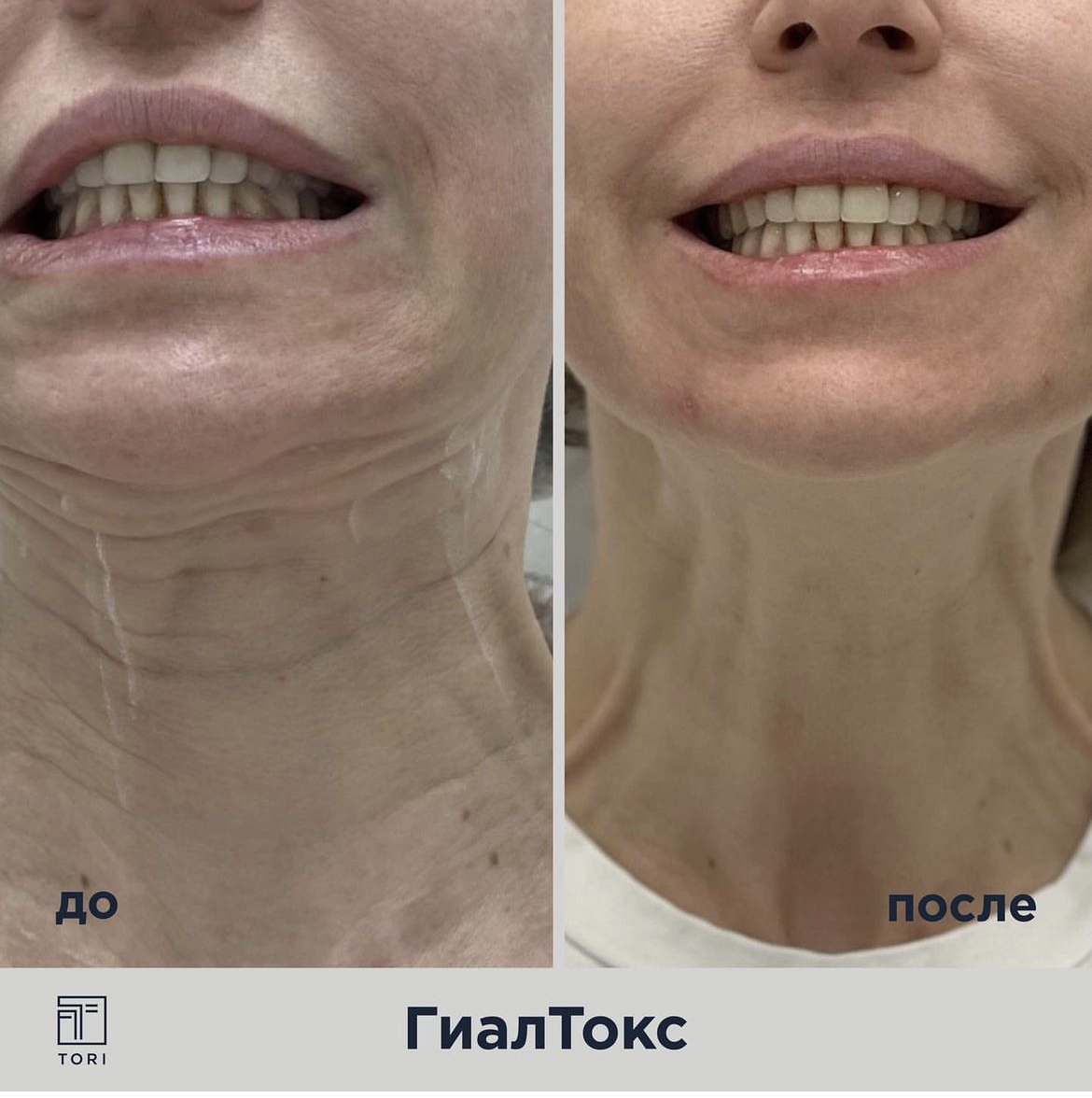 Медведева Екатерина Александровна косметолог - tori Clinic