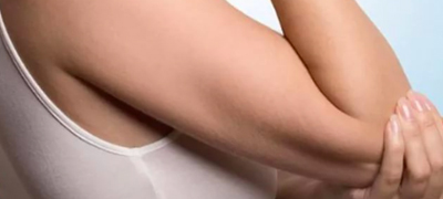 Почему шелушится кожа на локтях у женщин