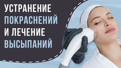 УСТРАНЕНИЕ ПОКРАСНЕНИЙ И ЛЕЧЕНИЕ ВЫСЫПАНИЙ