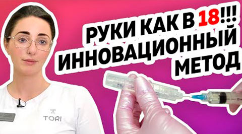 Возвращаем молодость рукам!  Radiesse - препарат будущего!