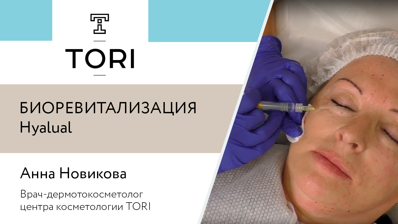 Биоревитализация Hyalual