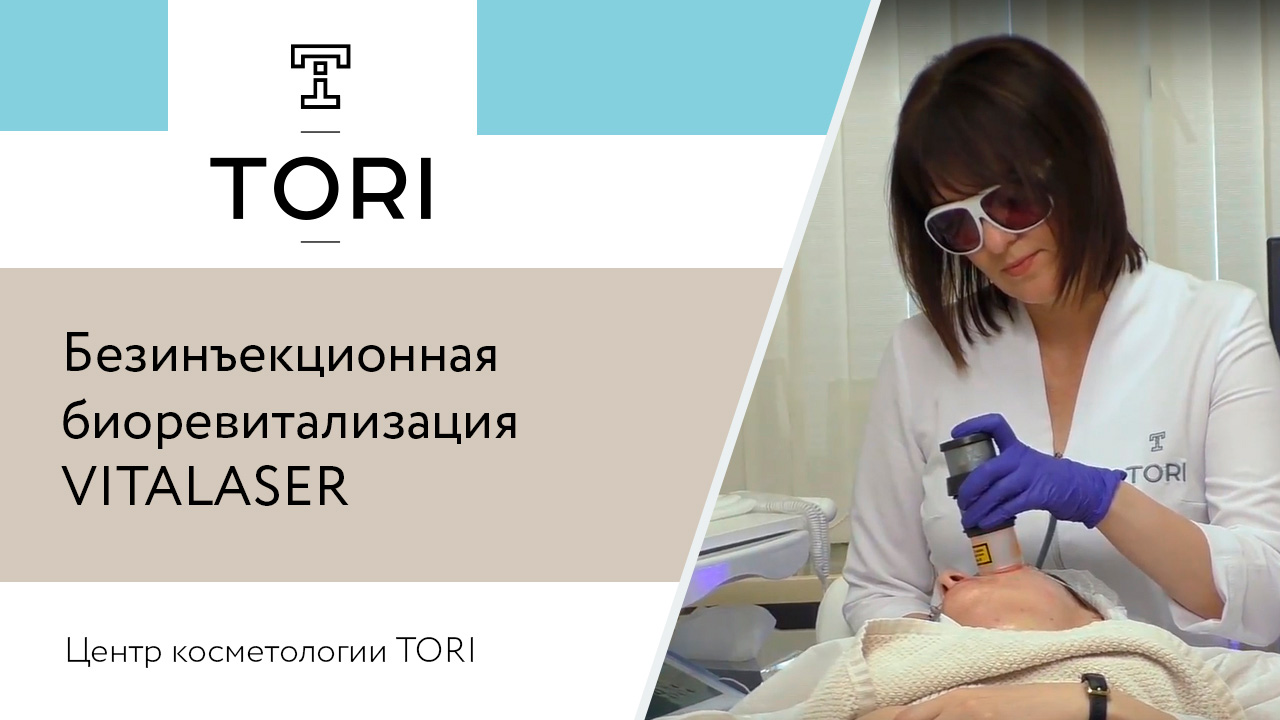 Безинъекционная биоревитализация VitaLaser
