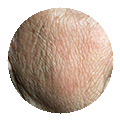 Лазерофорез гиалуроновой кислоты кожи лица thumbnail