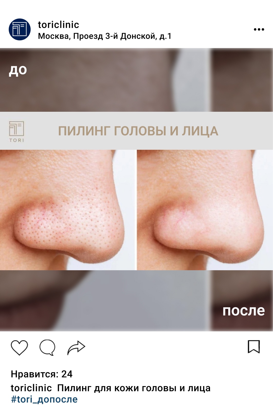 Пилинг (чистка) для кожи головы, цены в Москве