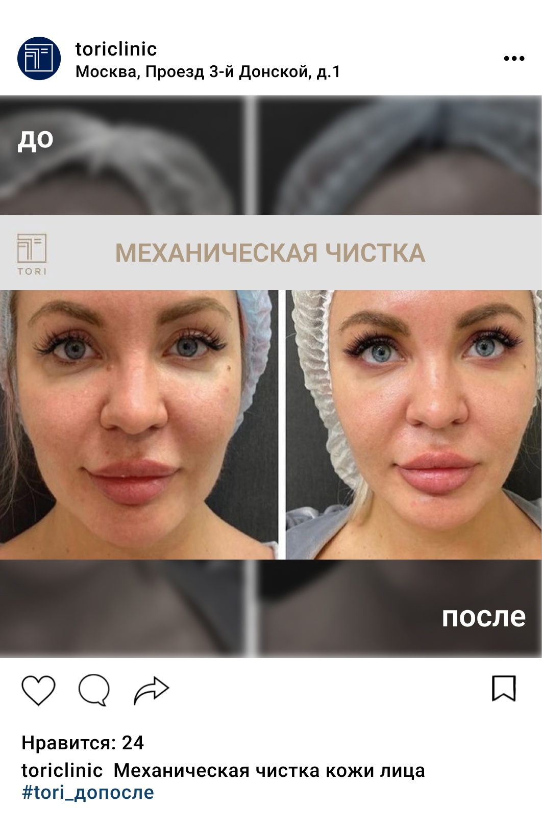 Сделать механическую чистку лица у косметолога в Москве - цены