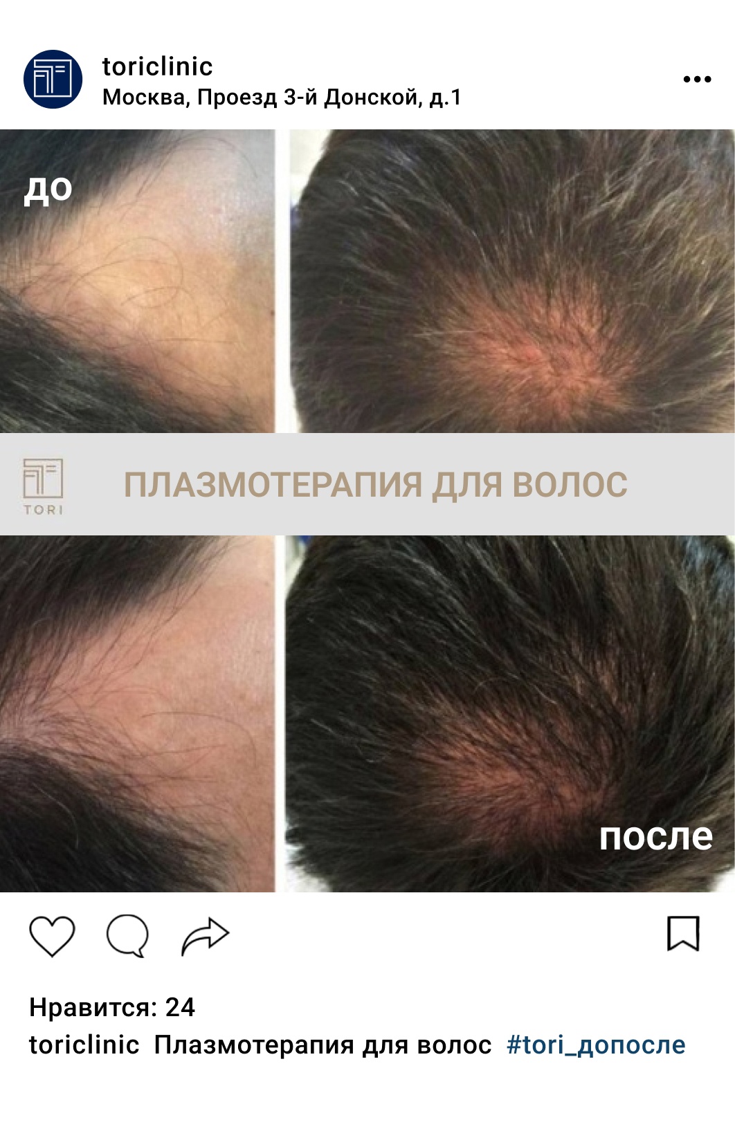 Ревакцинация от коронавируса: через сколько делать прививку, отзывы | Beauty Insider