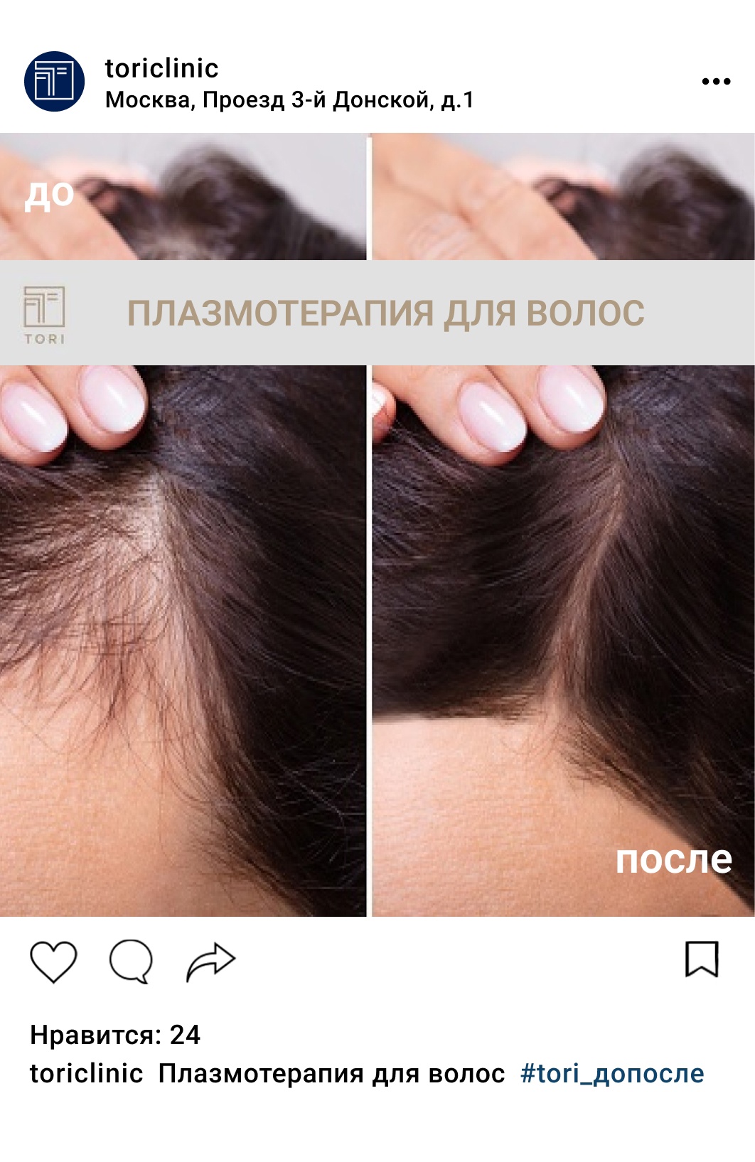 Плазмотерапия для волос цены в Москве
