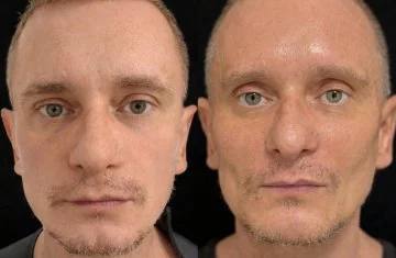 Косметология для мужчин: эффективные процедуры для сохранения молодости и красоты